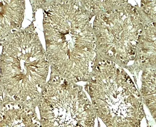 Anti-SOX4 antibody used in IHC (Paraffin sections) (IHC-P). GTX31613