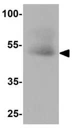 Anti-SOX4 antibody used in Western Blot (WB). GTX31613