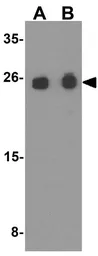 Anti-SNRPN antibody used in Western Blot (WB). GTX31617