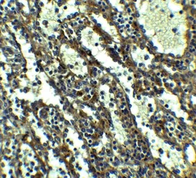 Anti-QSOX1 antibody used in IHC (Paraffin sections) (IHC-P). GTX31618