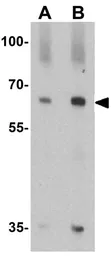 Anti-QSOX1 antibody used in Western Blot (WB). GTX31618