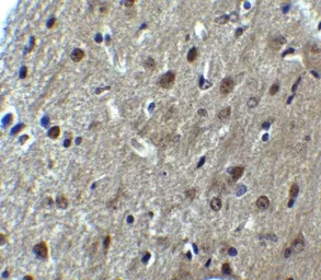 Anti-ARID1A antibody used in IHC (Paraffin sections) (IHC-P). GTX31619