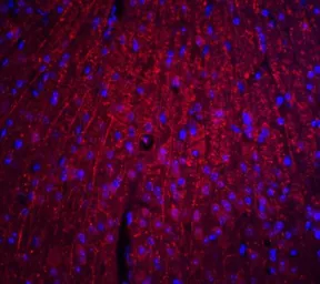Anti-ARID1A antibody used in IHC (Paraffin sections) (IHC-P). GTX31619