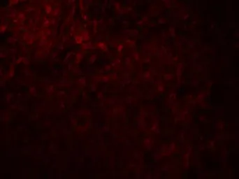 Anti-MAGEA4 antibody used in IHC (Paraffin sections) (IHC-P). GTX31620
