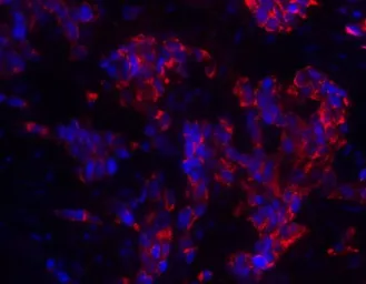 Anti-MAGEA4 antibody used in IHC (Paraffin sections) (IHC-P). GTX31620