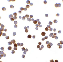 Anti-MAGEA4 antibody used in Immunocytochemistry/ Immunofluorescence (ICC/IF). GTX31620