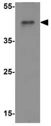 Anti-MAGEA4 antibody used in Western Blot (WB). GTX31620