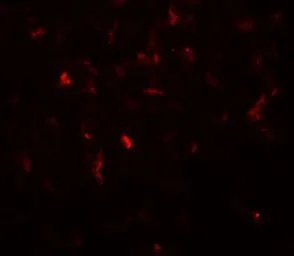 Anti-Hexokinase 1 antibody used in IHC (Paraffin sections) (IHC-P). GTX31625