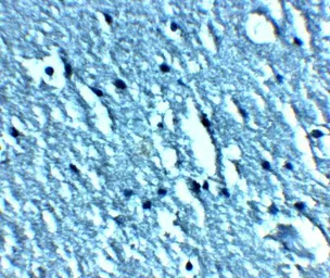 Anti-TRPC3 antibody used in IHC (Paraffin sections) (IHC-P). GTX31626