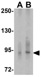 Anti-TRPC3 antibody used in Western Blot (WB). GTX31626