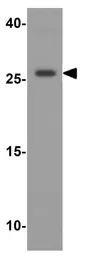 Anti-VTI1A antibody used in Western Blot (WB). GTX31627