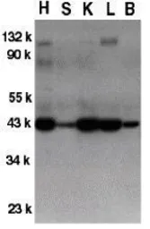 Anti-GFR alpha 3 antibody used in Western Blot (WB). GTX31634