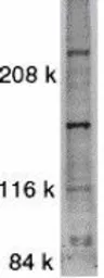 Anti-ASK1 antibody used in Western Blot (WB). GTX31637