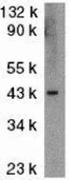 Anti-ICAD antibody used in Western Blot (WB). GTX31638