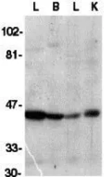 Anti-ICAD antibody used in Western Blot (WB). GTX31639