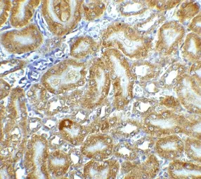 Anti-DFFB antibody used in IHC (Paraffin sections) (IHC-P). GTX31640