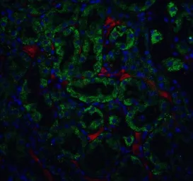 Anti-DFFB antibody used in IHC (Paraffin sections) (IHC-P). GTX31640