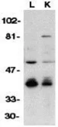 Anti-DFFB antibody used in Western Blot (WB). GTX31640