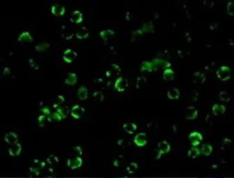Anti-IKK beta antibody used in Immunocytochemistry/ Immunofluorescence (ICC/IF). GTX31645