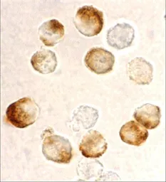 Anti-IKK beta antibody used in Immunocytochemistry/ Immunofluorescence (ICC/IF). GTX31645