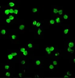 Anti-DRAK1 antibody used in Immunocytochemistry/ Immunofluorescence (ICC/IF). GTX31646