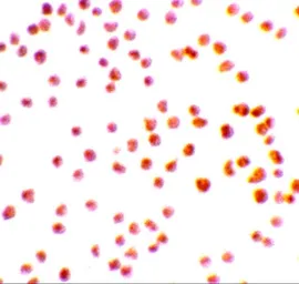 Anti-DRAK1 antibody used in Immunocytochemistry/ Immunofluorescence (ICC/IF). GTX31646