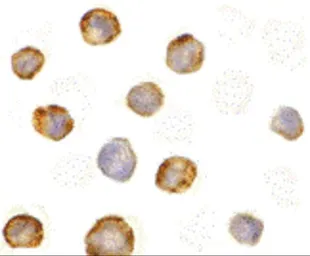Anti-RIP2 antibody used in Immunocytochemistry/ Immunofluorescence (ICC/IF). GTX31647