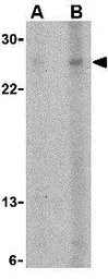 Anti-APRIL antibody used in Western Blot (WB). GTX31650