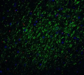 Anti-Survivin antibody used in IHC (Paraffin sections) (IHC-P). GTX31651