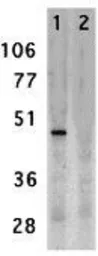 Anti-DC-SIGN antibody used in Western Blot (WB). GTX31657