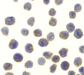 Anti-NAK / TBK1 antibody used in Immunocytochemistry/ Immunofluorescence (ICC/IF). GTX31658