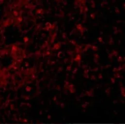 Anti-BCMA antibody used in IHC (Paraffin sections) (IHC-P). GTX31660
