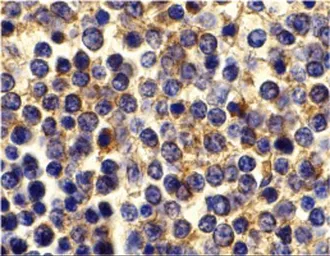 Anti-BCMA antibody used in IHC (Paraffin sections) (IHC-P). GTX31660