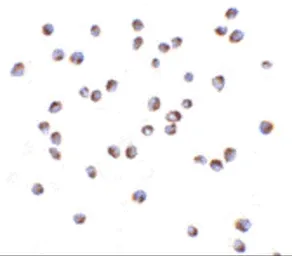 Anti-NOD2 antibody used in Immunocytochemistry/ Immunofluorescence (ICC/IF). GTX31664