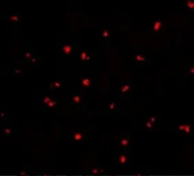 Anti-NOD2 antibody used in Immunocytochemistry/ Immunofluorescence (ICC/IF). GTX31664