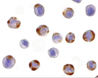 Anti-NOD2 antibody used in Immunocytochemistry/ Immunofluorescence (ICC/IF). GTX31665
