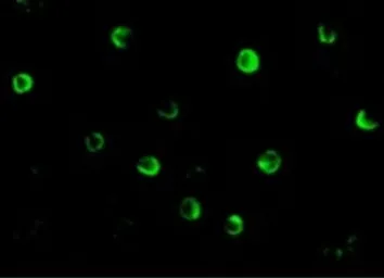 Anti-NOD2 antibody used in Immunocytochemistry/ Immunofluorescence (ICC/IF). GTX31665