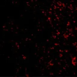 Anti-PAK4 antibody used in IHC (Paraffin sections) (IHC-P). GTX31673