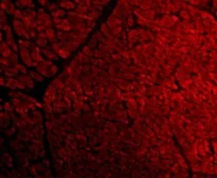 Anti-TIRAP antibody used in IHC (Paraffin sections) (IHC-P). GTX31676