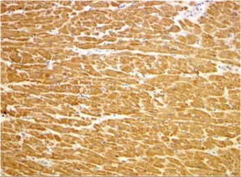 Anti-TIRAP antibody used in IHC (Paraffin sections) (IHC-P). GTX31676