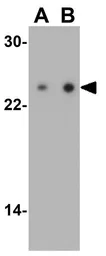 Anti-TIRAP antibody used in Western Blot (WB). GTX31676