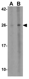 Anti-BCL2L10 antibody used in Western Blot (WB). GTX31677