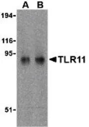 Anti-TLR11 antibody used in Western Blot (WB). GTX31682