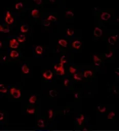 Anti-TLR11 antibody used in Immunocytochemistry/ Immunofluorescence (ICC/IF). GTX31682