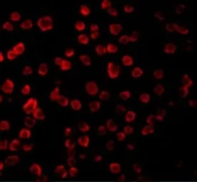 Anti-TLR11 antibody used in Immunocytochemistry/ Immunofluorescence (ICC/IF). GTX31683