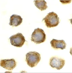 Anti-TLR11 antibody used in Immunocytochemistry/ Immunofluorescence (ICC/IF). GTX31683