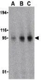 Anti-TLR11 antibody used in Western Blot (WB). GTX31683