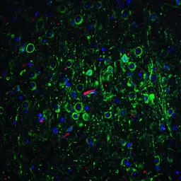 Anti-Bcl-2 antibody used in IHC (Paraffin sections) (IHC-P). GTX31686