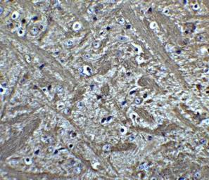 Anti-Bcl-2 antibody used in IHC (Paraffin sections) (IHC-P). GTX31686