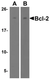 Anti-Bcl-2 antibody used in Western Blot (WB). GTX31687